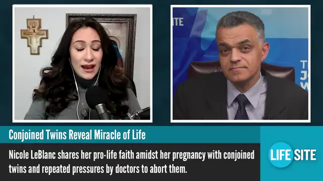 Twin baby girls: Conjoined and doomed to die | A mother's moving