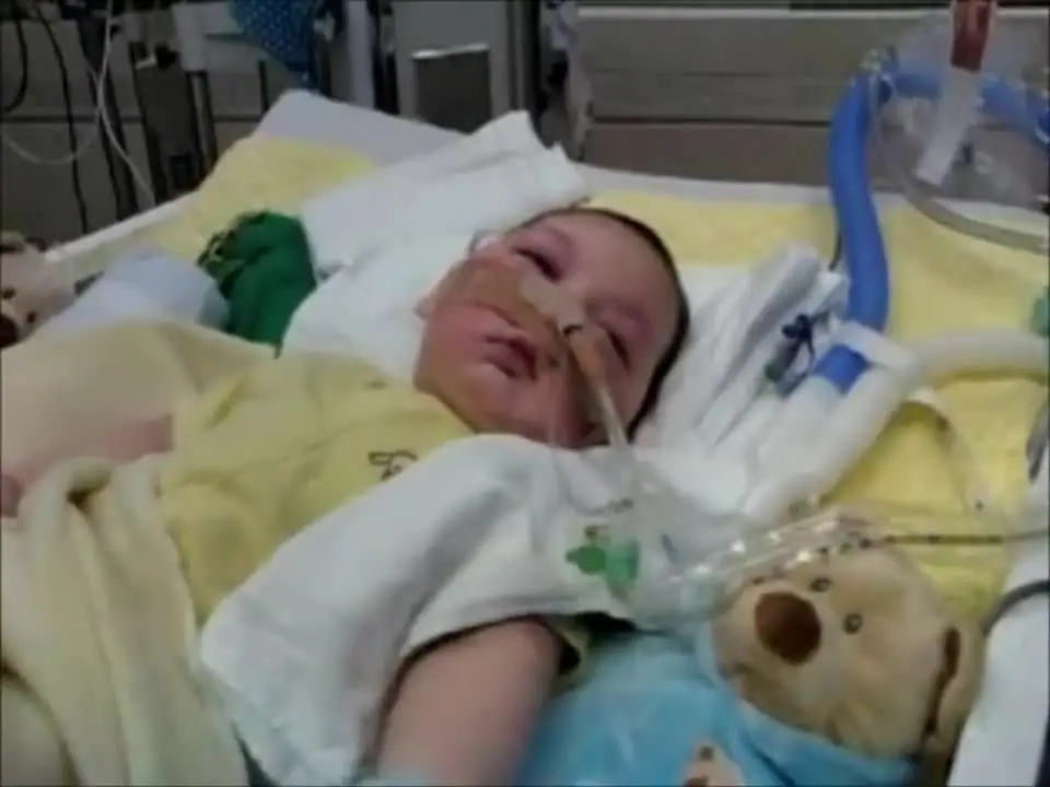 Baby Joseph NOT in vegetative state