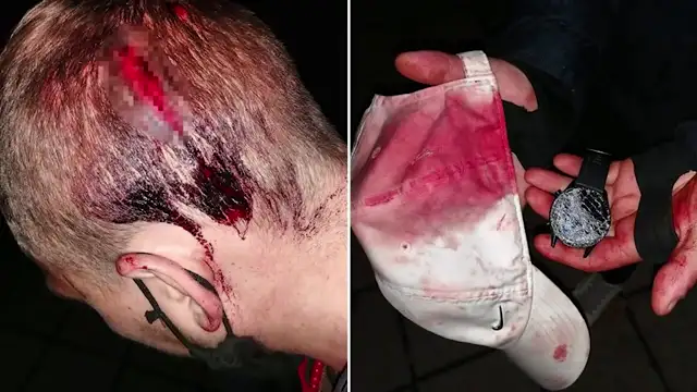 Faithful Catholics in Poland stand up to rioters trying to vandalize statues, churches