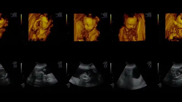 Irish archbishop criticizes peaceful pro-life protests