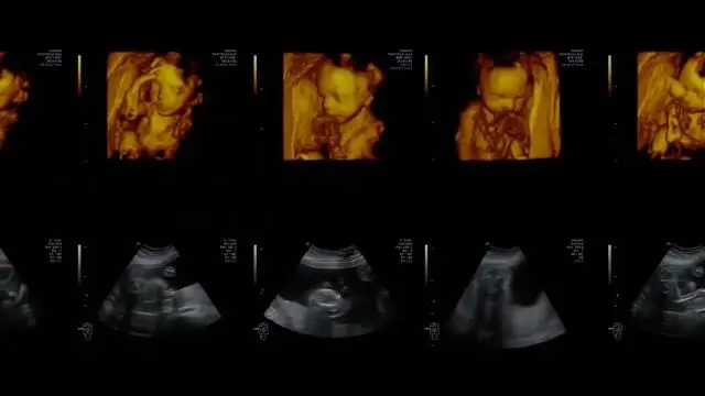 Irish archbishop criticizes peaceful pro-life protests